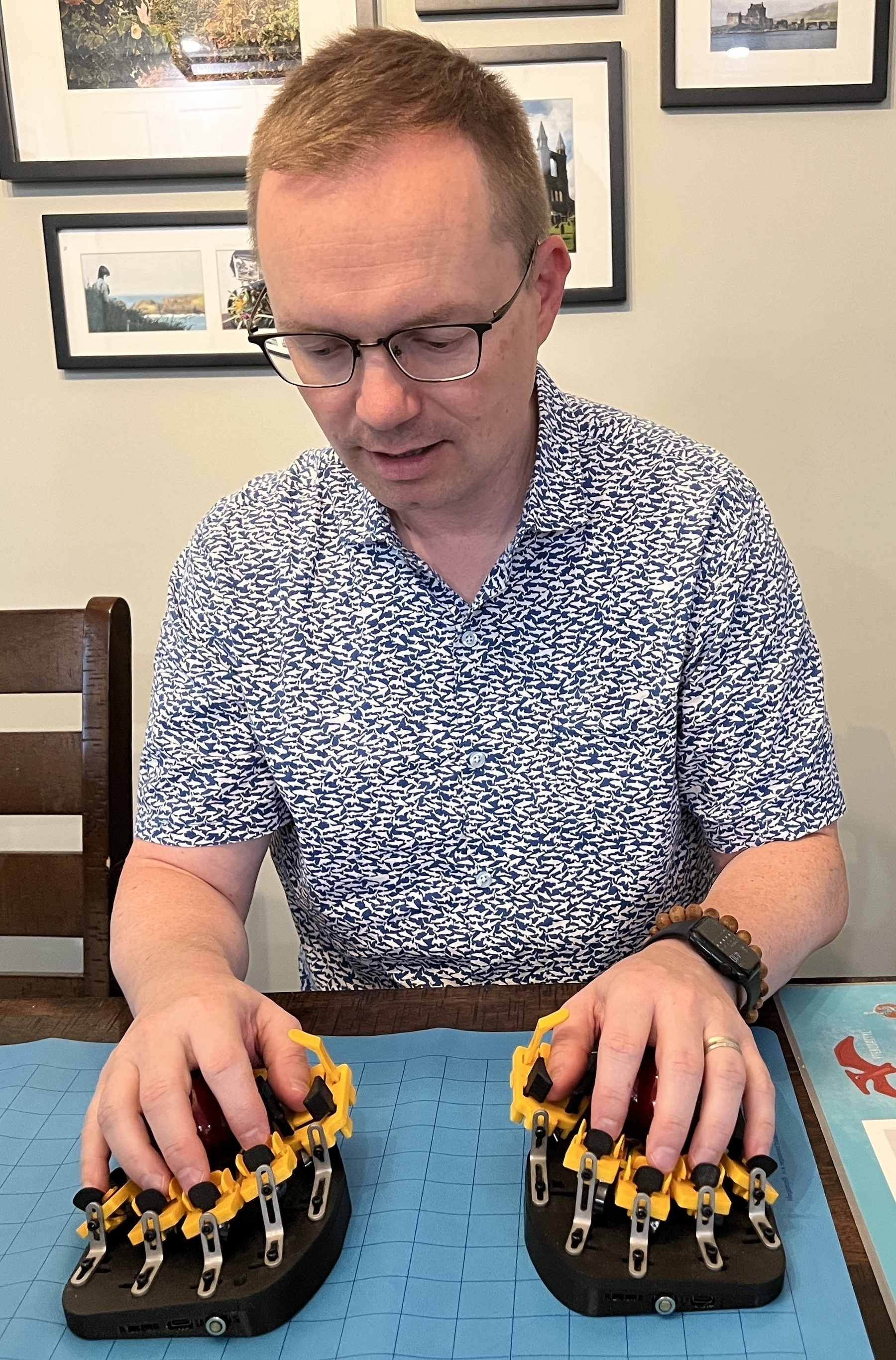 Chad with hands on (in?) the left and right hand keyboard units. Each finger rests on a key, but there are switches up, down, left, and right of each fingertip that can be triggered by moving the finger.  The palms rest on large trackballs which replace a mouse and scroll wheel. 