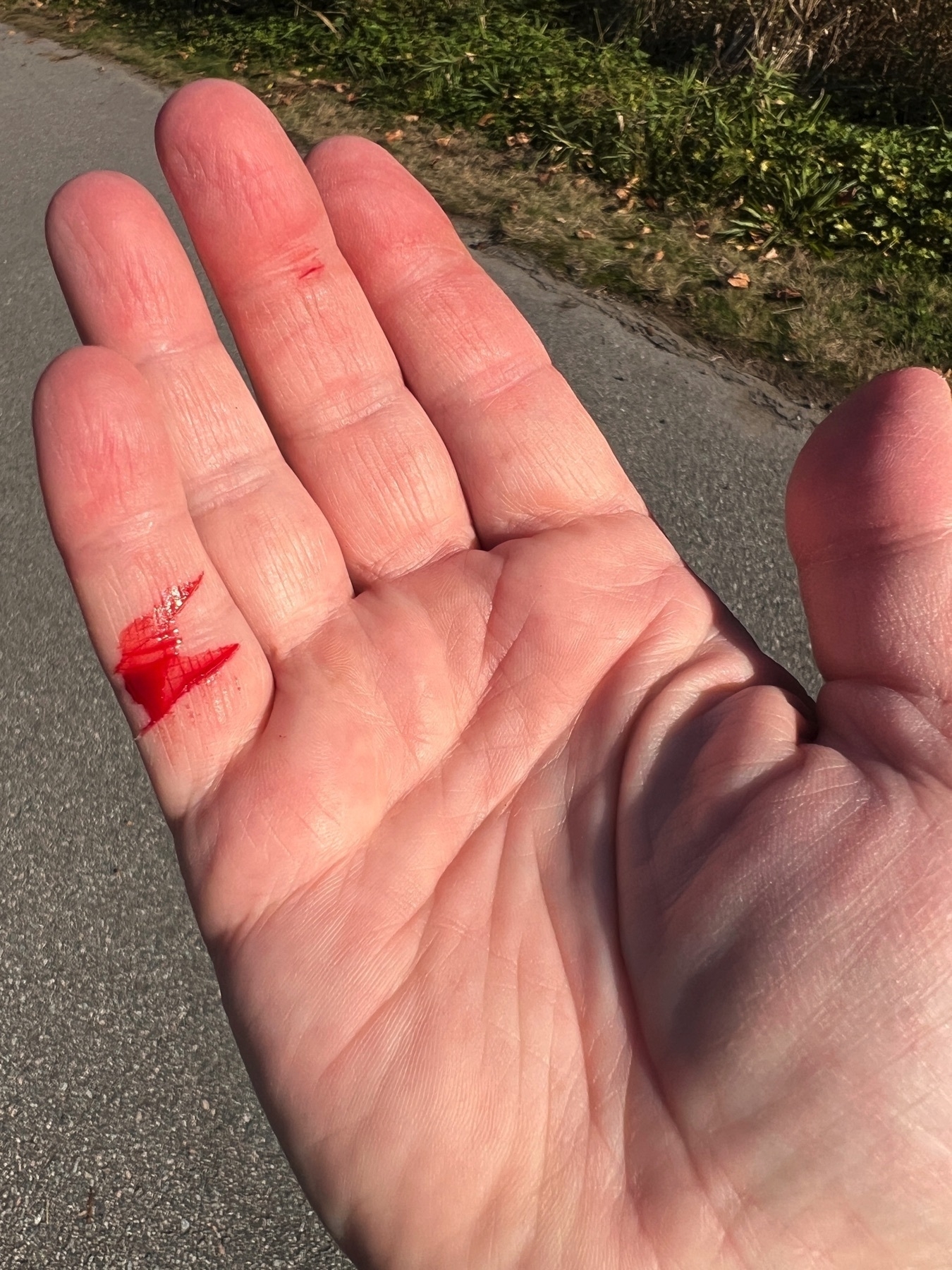 bright red blood wells up from two thin paper-cut-like slashs in Chad’s pinkie finger