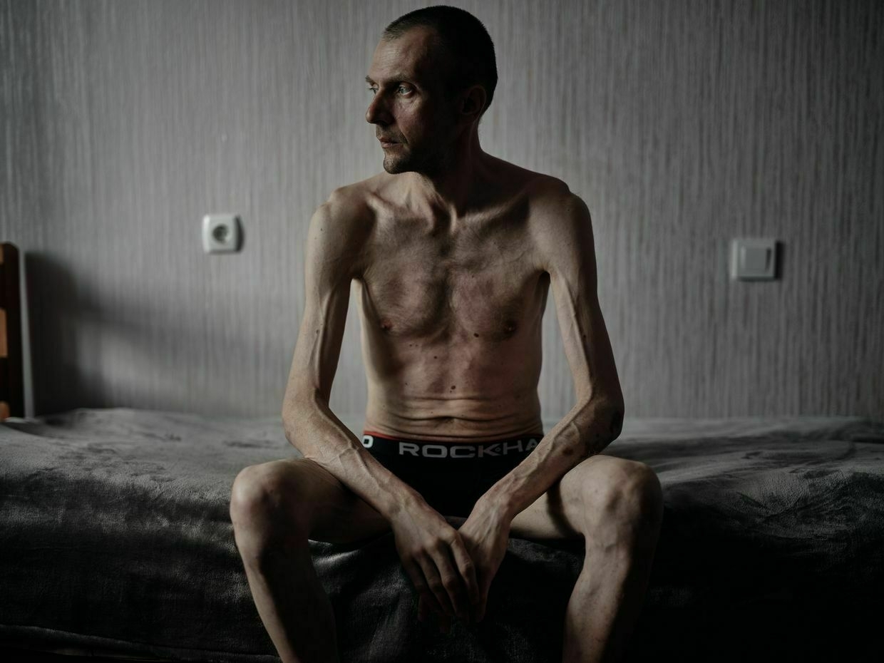 The shocking toll of Russian captivity on Ukrainian prisoners of war