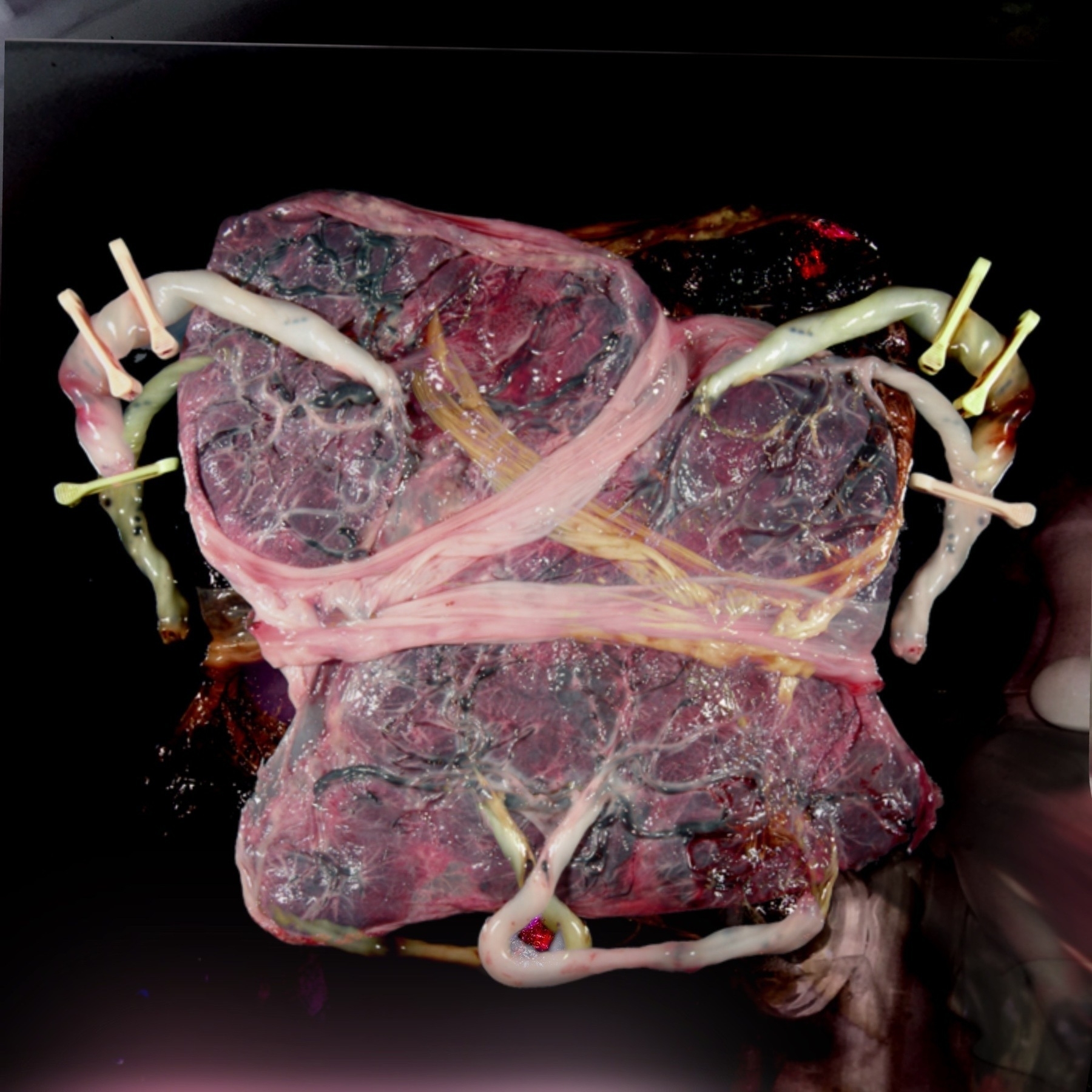 Auto-generated description: A piece of meat is wrapped with an intricate pattern of thin ropes and threaded objects.