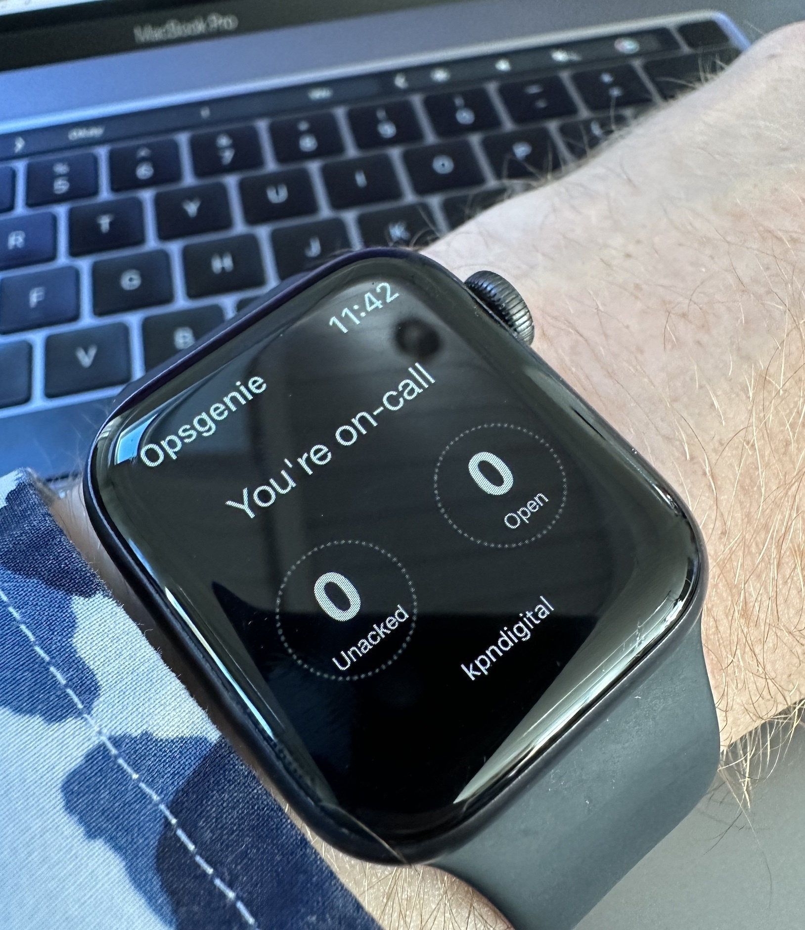 Apple Watch showing that I'm on call. 