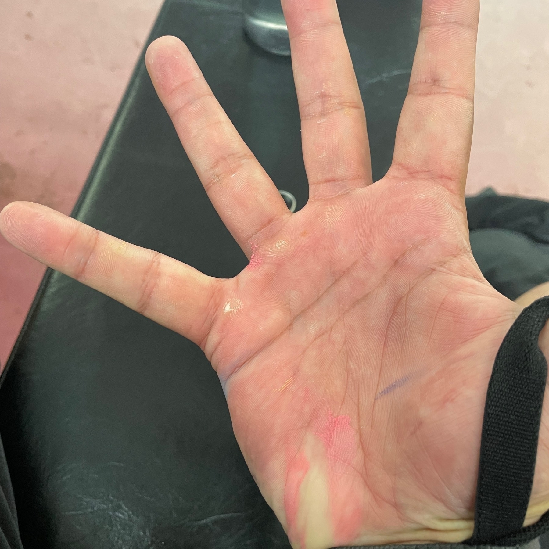 Palm of hand with pink paint and calluses from exercise 