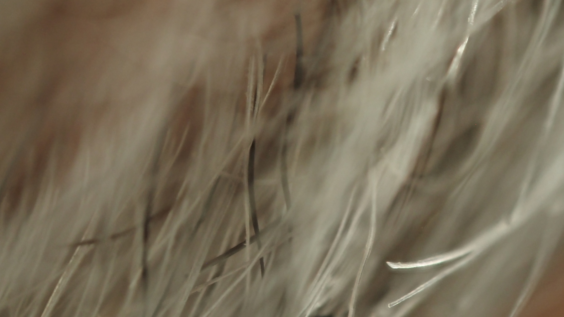 close-up of mostly white beard