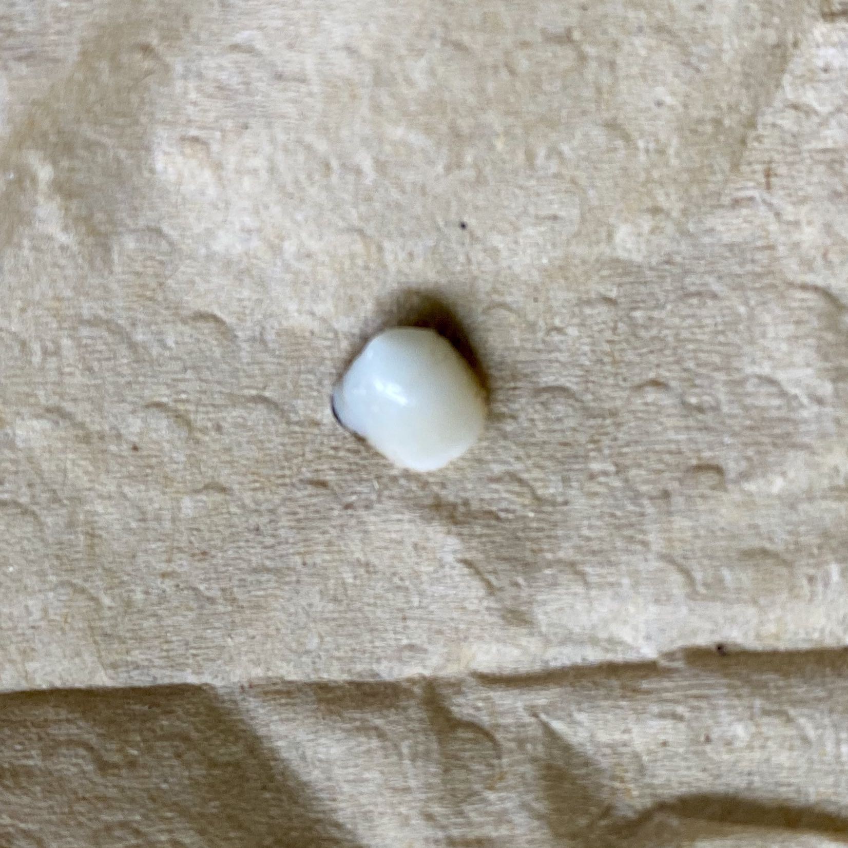 This piece of tooth is supposed to be attached to the rest inside my mouth!