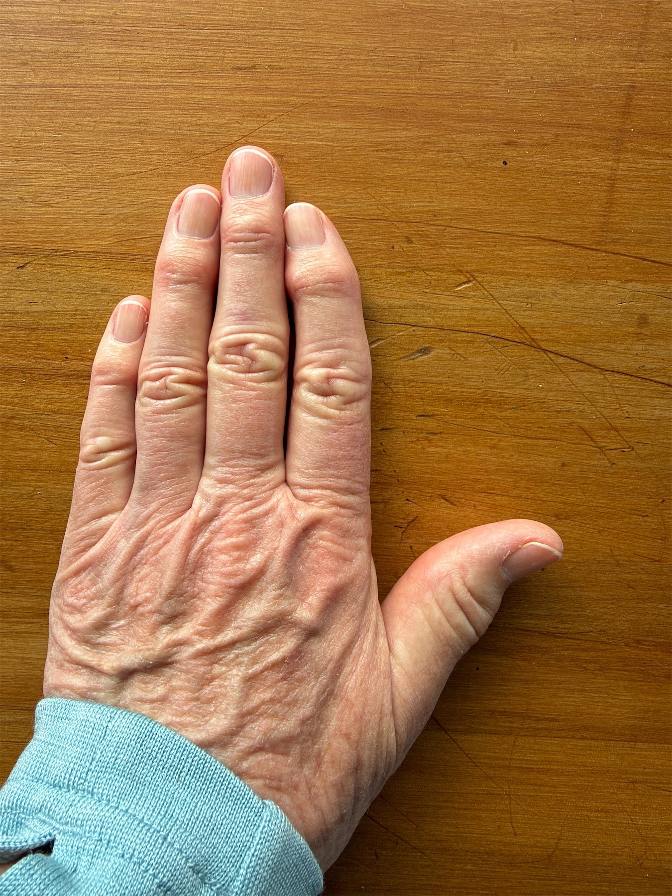 My left hand shows the fingers are bending.