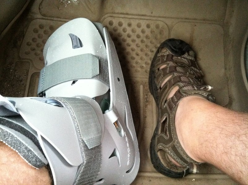 Justin's left foot in a walking boot next to his right foot in a sandal