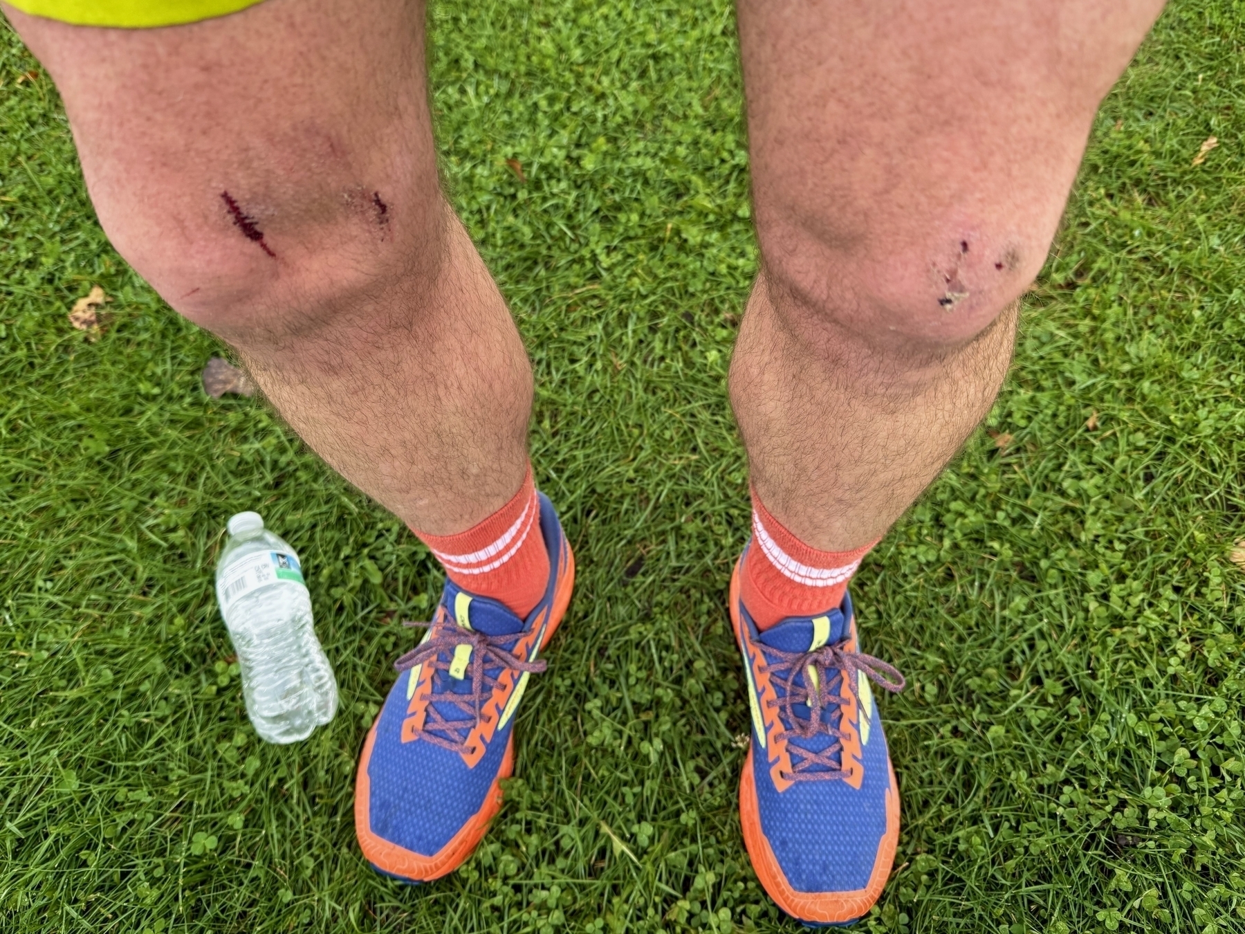 Scraped knees show cuts and dirt, while legs stand on grass. Bright blue and orange running shoes, paired with red socks, are near a plastic water bottle on the ground.