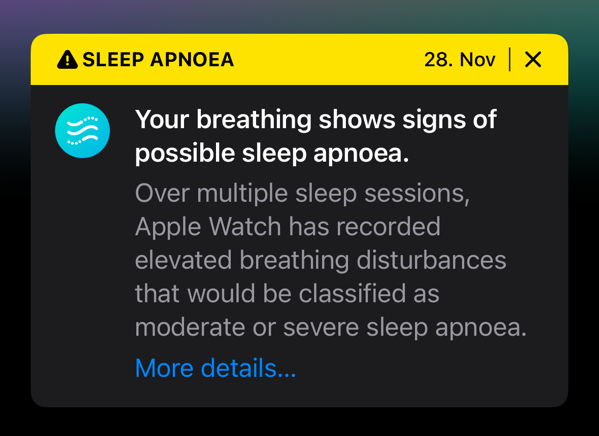 A screenshot from my Apple Health app with a warning from 28. Nov that reads: "Your breathing shows signs of possible sleep apnoea.
Over multiple sleep sessions, Apple Watch has recorded elevated breathing disturbances that would be classified as moderate or severe sleep apnoea."