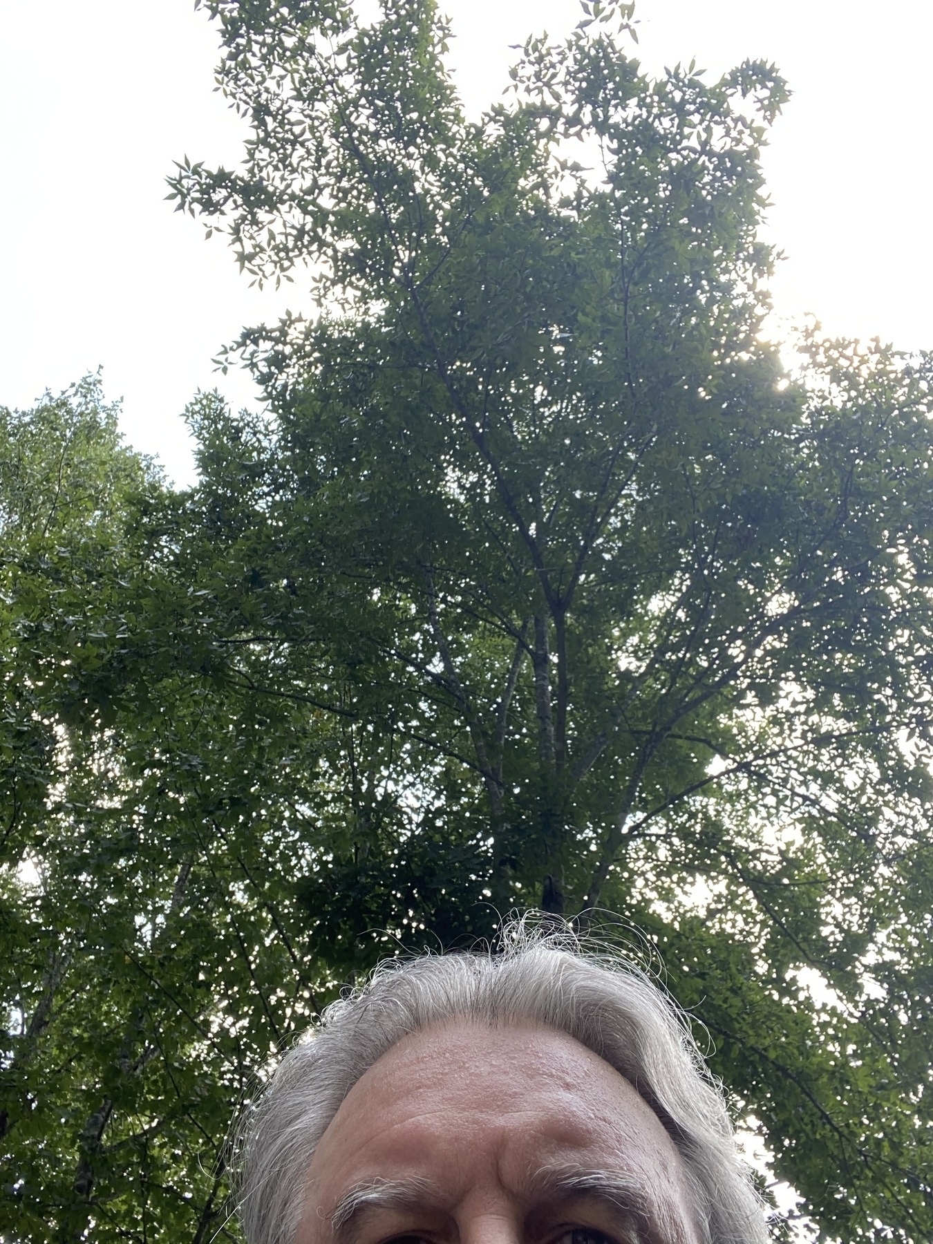 A picture of the top part of my gray head with a tree in the background.