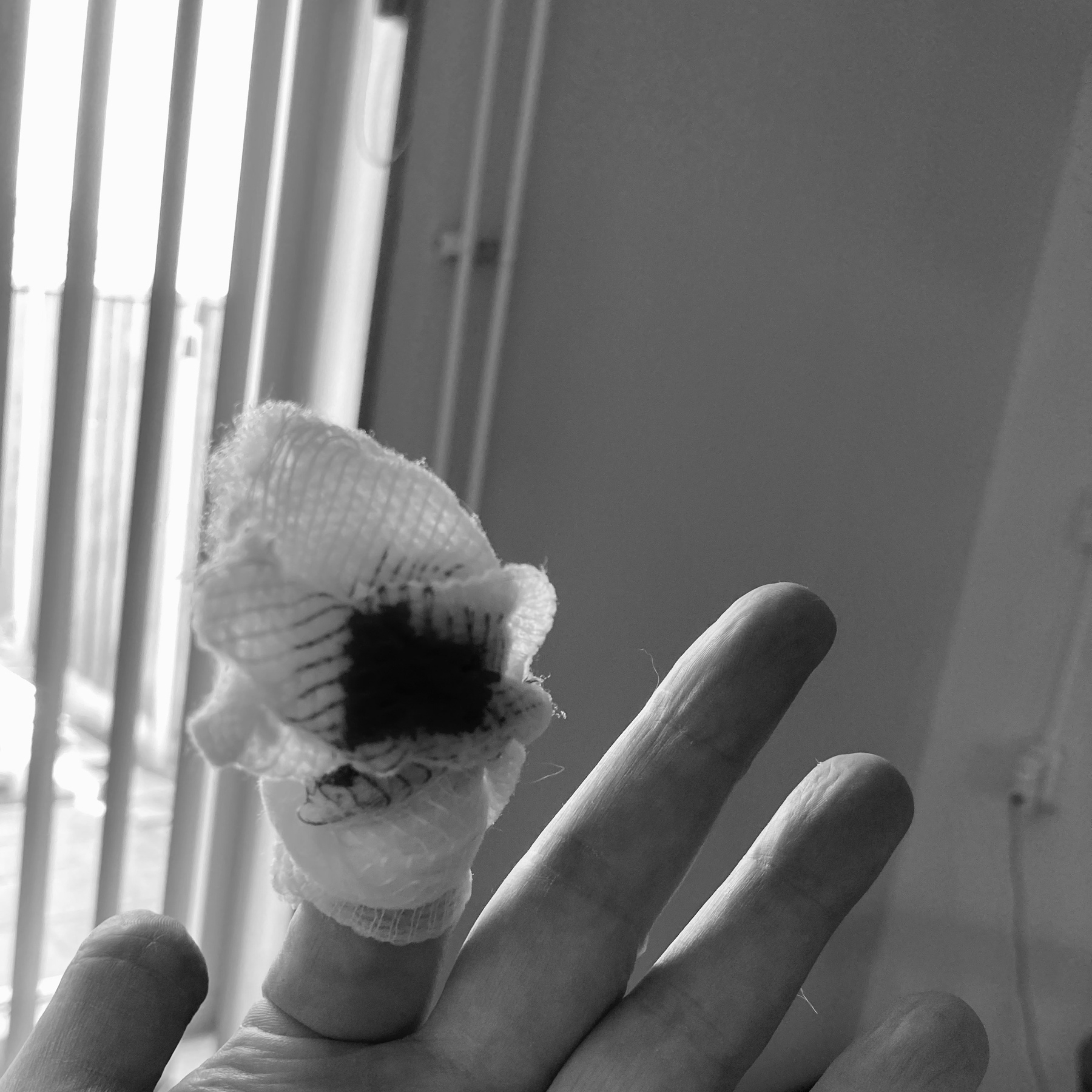 B&W photo of bandaged finger