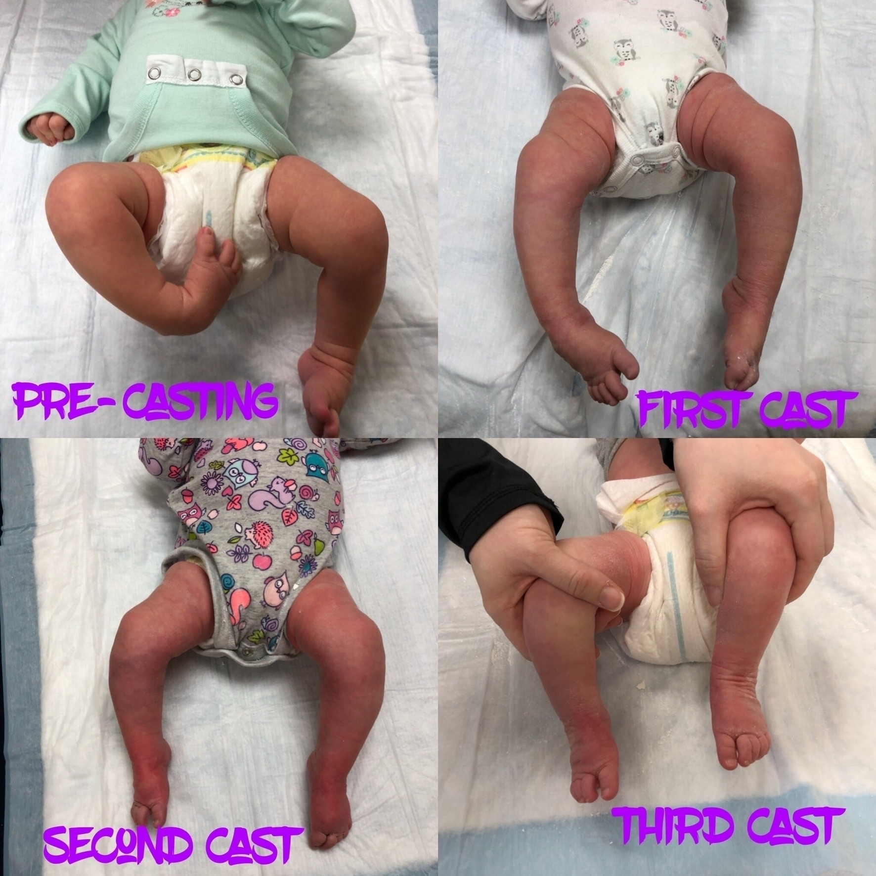 Photo of little one’s first four treatments