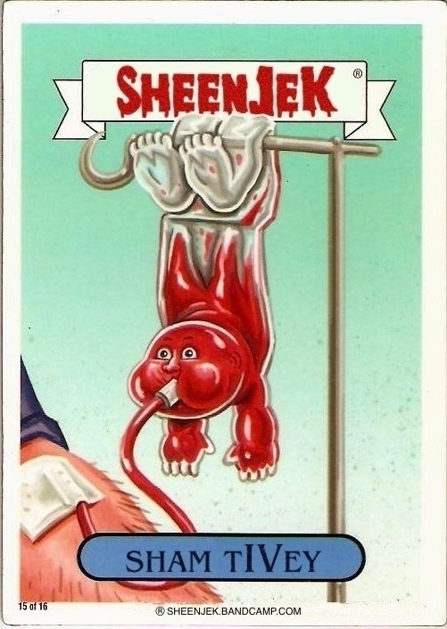 A garbage pail kids card with a kid filled with blood like a transfusion bag. It is being emptied via a transfusion tube. Text: “SHEENJEK” and “SHAM TIVEY” with an emphasis on IV with “SHEENJEK.BANDCAMP.COM”.